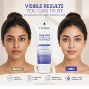 Charwee Dark Spot Corrector For Face with Active Brightening Blend